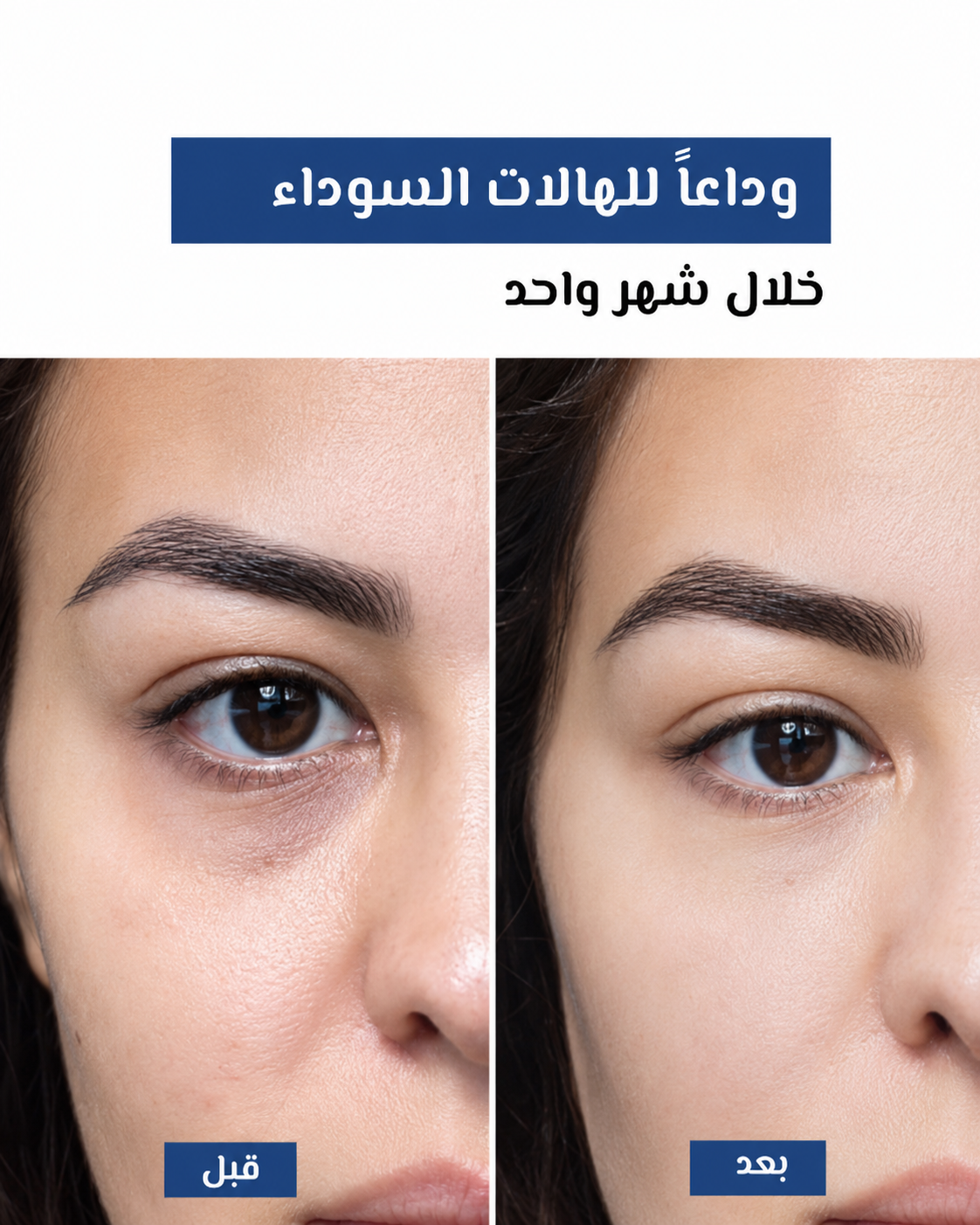 استمتعي بالثقة في كل لحظة حميمة مع زوجك — وداعاً للمناطق الحساسة الداكنة