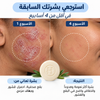 Voted No. 1 in France for Psoriasis
