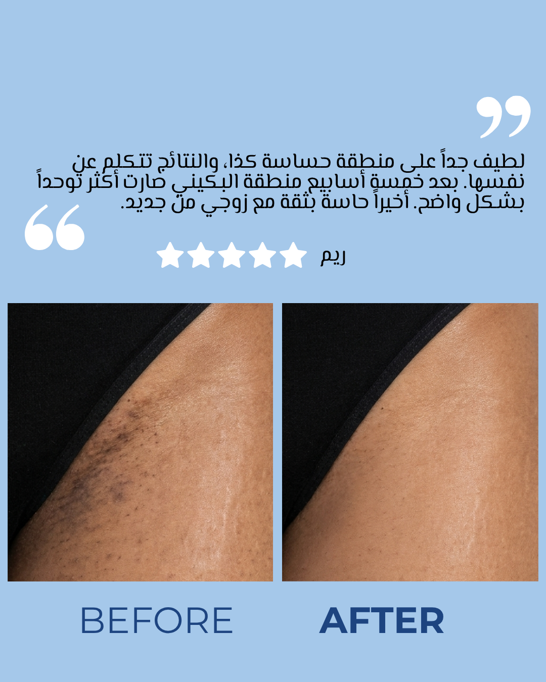 ثنائي إشراقة ناصعة البياض