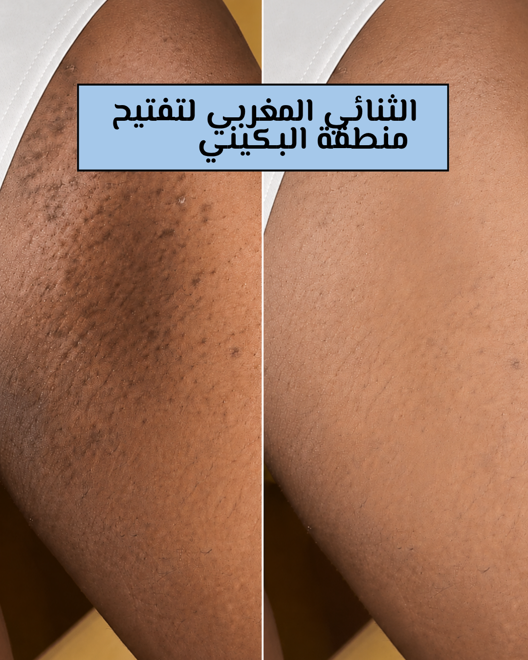 ثنائي إشراقة ناصعة البياض