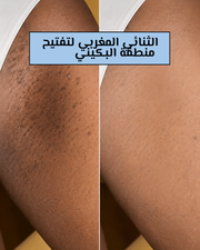 ثنائي إشراقة ناصعة البياض
