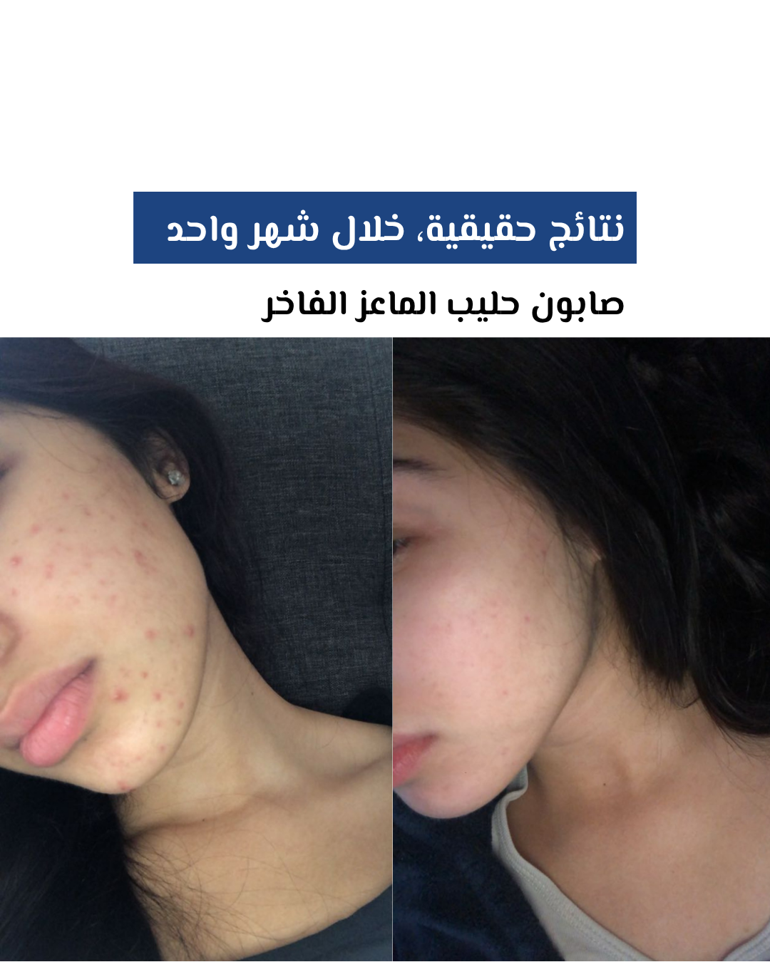صابون حليب الماعز الفاخر