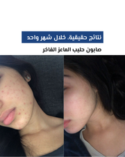 صابون حليب الماعز الفاخر