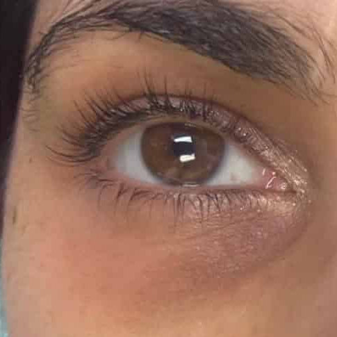 Before