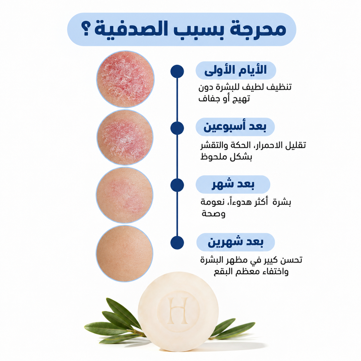 Voted No. 1 in France for Psoriasis
