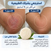 Voted No. 1 in France for Eczema